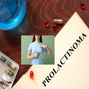 Prolactinoma